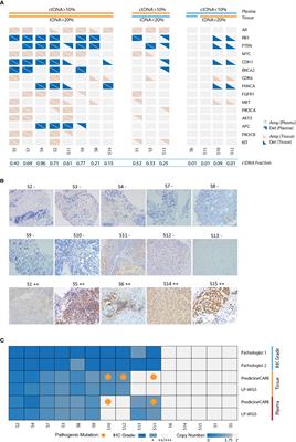 Circulating Cell-Free DNA-Based Detection of Tumor Suppressor Gene Copy Number Loss and Its Clinical Implication in Metastatic Prostate Cancer